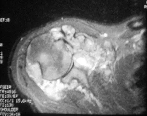 Shoulder 2026 MCQs: Board Review Questions & Answers (Part 1) - Figure 87