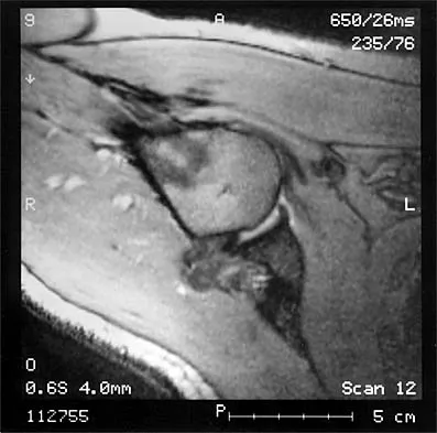 Shoulder 2026 MCQs: Board Review Questions & Answers (Part 1) - Figure 9
