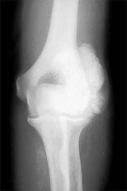 Shoulder 2026 MCQs: Board Review Questions & Answers (Part 1) - Figure 97