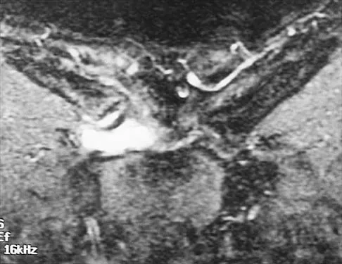 Shoulder 2026 MCQs: Board Review Questions & Answers (Part 2) - Figure 101