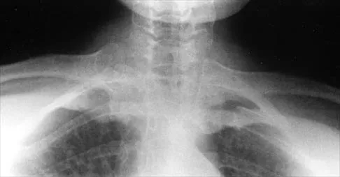 Shoulder 2026 MCQs: Board Review Questions & Answers (Part 2) - Figure 103