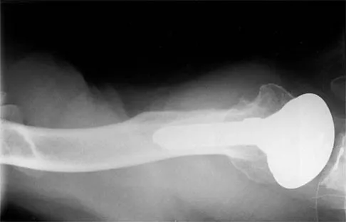 Shoulder 2026 MCQs: Board Review Questions & Answers (Part 2) - Figure 17