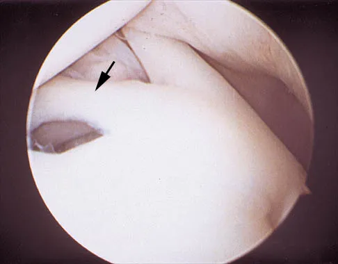 Shoulder 2026 MCQs: Board Review Questions & Answers (Part 2) - Figure 25