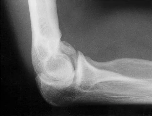 Shoulder 2026 MCQs: Board Review Questions & Answers (Part 2) - Figure 45