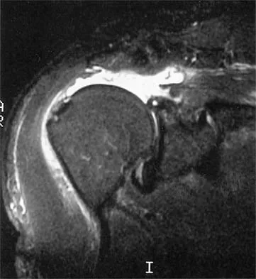 Shoulder 2026 MCQs: Board Review Questions & Answers (Part 2) - Figure 7