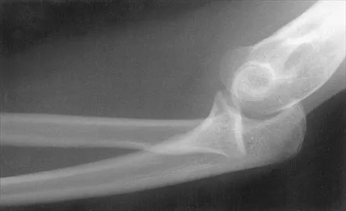 Shoulder 2026 MCQs: Board Review Questions & Answers (Part 2) - Figure 81