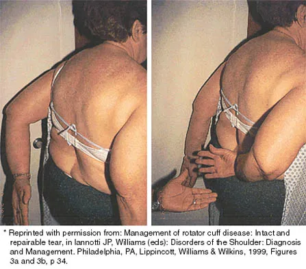 Shoulder 2026 MCQs: Board Review Questions & Answers (Part 2) - Figure 91