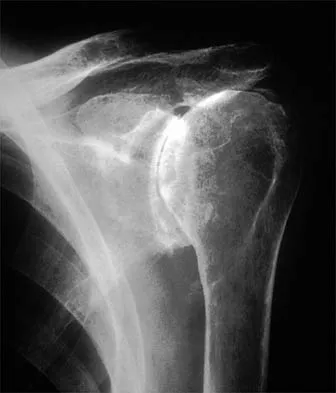 Shoulder 2026 MCQs: Board Review Questions & Answers (Part 2) - Figure 97