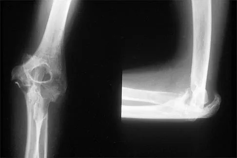 Shoulder 2026 MCQs: Board Review Questions & Answers (Part 3) - Figure 13