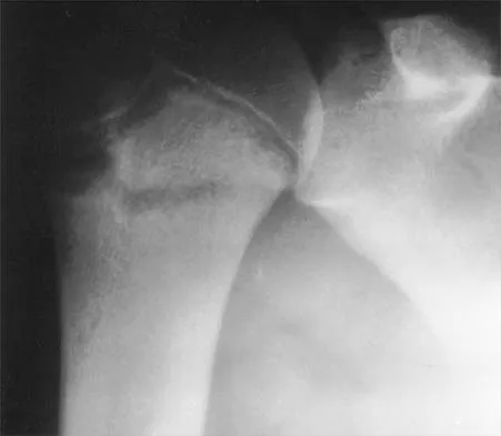 Shoulder 2026 MCQs: Board Review Questions & Answers (Part 3) - Figure 15