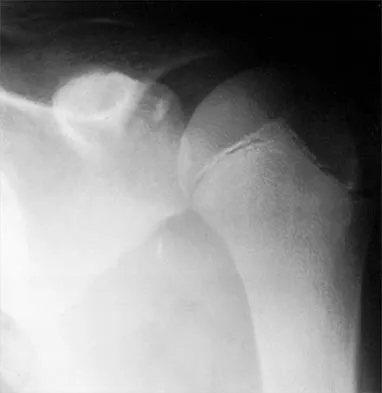 Shoulder 2026 MCQs: Board Review Questions & Answers (Part 3) - Figure 17