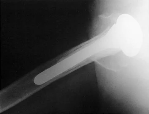 Shoulder 2026 MCQs: Board Review Questions & Answers (Part 3) - Figure 35