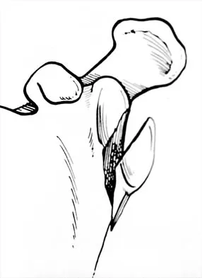 Shoulder 2026 MCQs: Board Review Questions & Answers (Part 4) - Figure 19