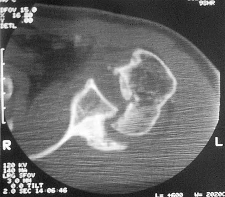 Shoulder 2026 MCQs: Board Review Questions & Answers (Part 4) - Figure 31