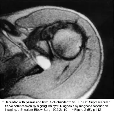 Shoulder 2026 MCQs: Board Review Questions & Answers (Part 4) - Figure 35