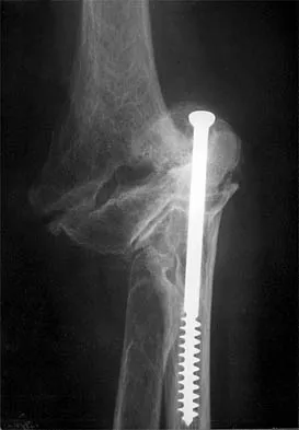 Shoulder 2026 MCQs: Board Review Questions & Answers (Part 4) - Figure 7