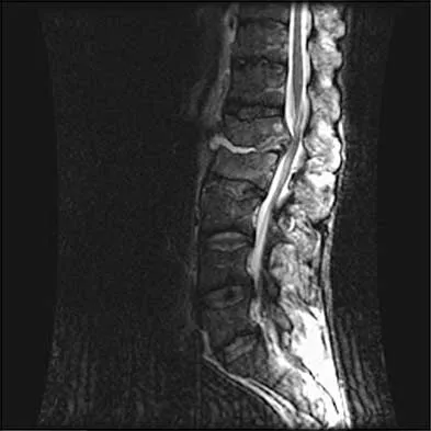 Spine 2026 MCQs: Board Review Questions & Answers (Part 1) - Figure 115