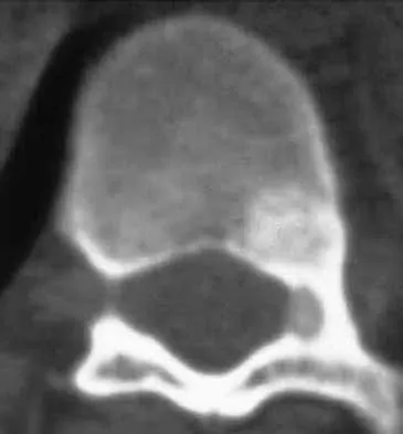 Spine 2026 MCQs: Board Review Questions & Answers (Part 1) - Figure 117