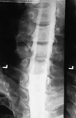 Spine 2026 MCQs: Board Review Questions & Answers (Part 1) - Figure 131