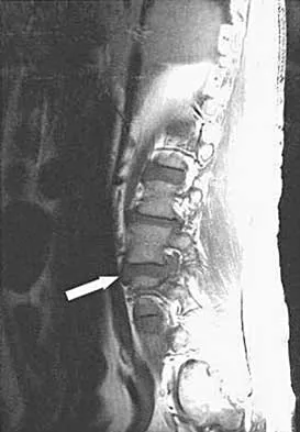 Spine 2026 MCQs: Board Review Questions & Answers (Part 1) - Figure 135