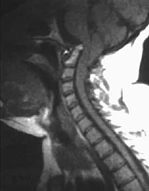 Spine 2026 MCQs: Board Review Questions & Answers (Part 1) - Figure 147