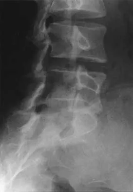 Spine 2026 MCQs: Board Review Questions & Answers (Part 1) - Figure 163