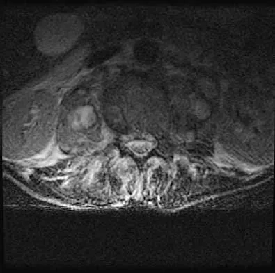 Spine 2026 MCQs: Board Review Questions & Answers (Part 1) - Figure 35