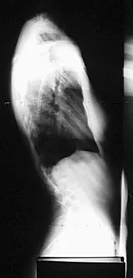 Spine 2026 MCQs: Board Review Questions & Answers (Part 1) - Figure 41