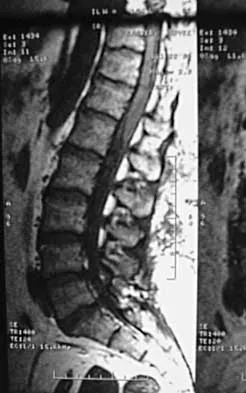 Spine 2026 MCQs: Board Review Questions & Answers (Part 1) - Figure 5
