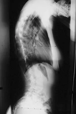 Spine 2026 MCQs: Board Review Questions & Answers (Part 1) - Figure 89