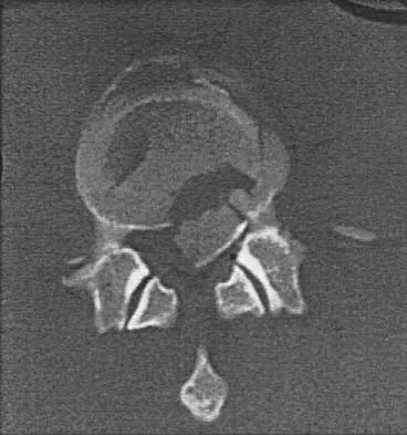 Spine 2026 MCQs: Board Review Questions & Answers (Part 2) - Figure 14