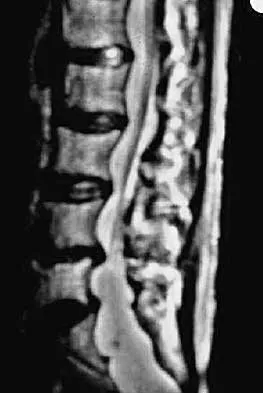 Spine 2026 MCQs: Board Review Questions & Answers (Part 2) - Figure 26