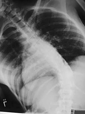 Spine 2026 MCQs: Board Review Questions & Answers (Part 2) - Figure 58