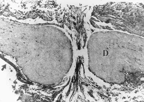 Spine 2026 MCQs: Board Review Questions & Answers (Part 2) - Figure 64