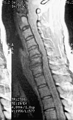 Spine 2026 MCQs: Board Review Questions & Answers (Part 2) - Figure 7