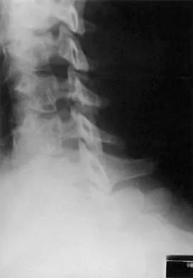 Spine 2026 MCQs: Board Review Questions & Answers (Part 2) - Figure 72