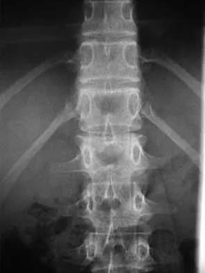 Spine 2026 MCQs: Board Review Questions & Answers (Part 3) - Figure 13