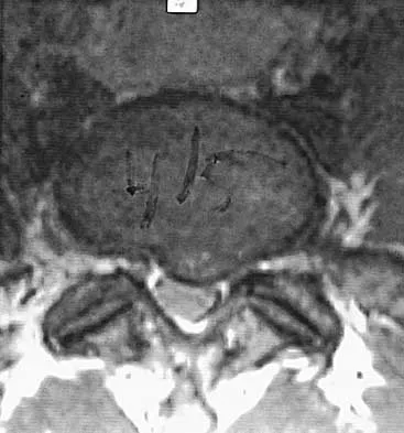 Spine 2026 MCQs: Board Review Questions & Answers (Part 4) - Figure 13