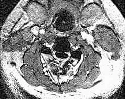 Spine 2026 MCQs: Board Review Questions & Answers (Part 4) - Figure 19