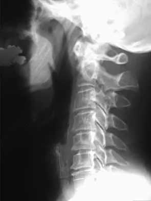 Spine 2026 MCQs: Board Review Questions & Answers (Part 4) - Figure 23