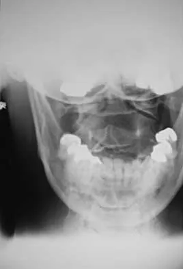 Spine 2026 MCQs: Board Review Questions & Answers (Part 4) - Figure 25