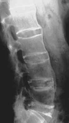 Spine 2026 MCQs: Board Review Questions & Answers (Part 4) - Figure 3