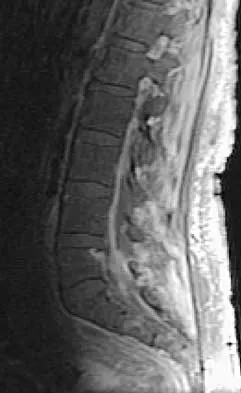 Spine 2026 MCQs: Board Review Questions & Answers (Part 4) - Figure 7