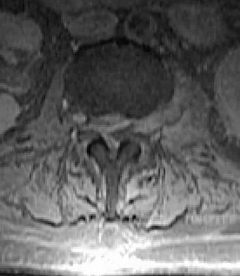 Spine 2026 MCQs: Board Review Questions & Answers (Part 4) - Figure 9