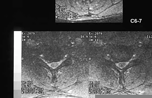 Spine Surgery 2000 Practice Questions: Set 3 (Solved) Figure 1
