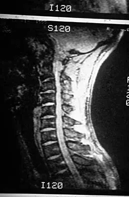 Spine Surgery 2000 Practice Questions: Set 1 (Solved) - Figure 13
