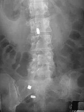 Spine Surgery 2000 Practice Questions: Set 1 (Solved) - Figure 14
