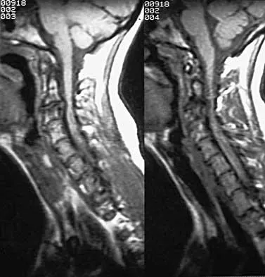 Spine Surgery 2000 Practice Questions: Set 1 (Solved) - Figure 18