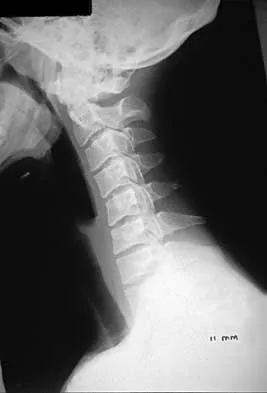Spine Surgery 2000 Practice Questions: Set 1 (Solved) - Figure 2
