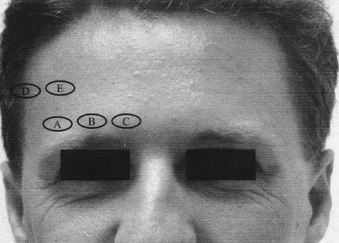 Spine Surgery 2000 Practice Questions: Set 1 (Solved) - Figure 23